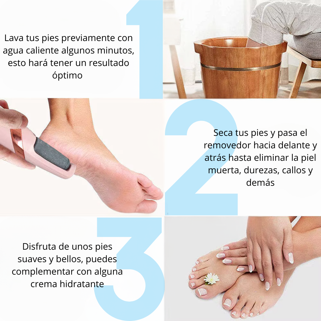 Myfeet™ Removedora Eléctrica De Callos - Rejuvenece tus pies