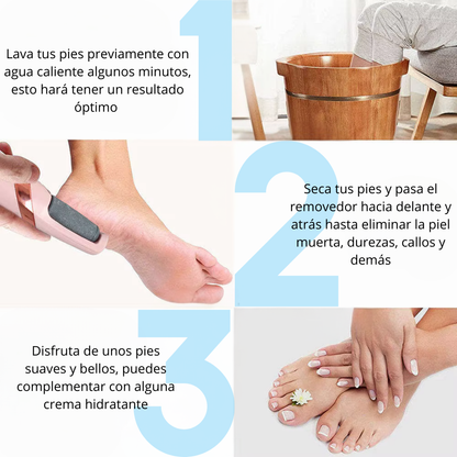 Myfeet™ Removedora Eléctrica De Callos - Rejuvenece tus pies