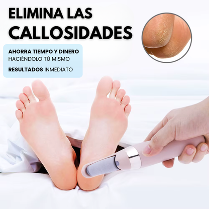 Myfeet™ Removedora Eléctrica De Callos - Rejuvenece tus pies